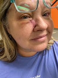 Celebrating 50th birthday despite health issues