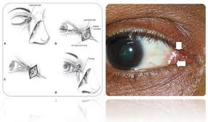 Retinagoz Private Eye Hospital