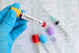 Hepatitis a, b, and c spread in very different ways, causing mild to serious effects on the liver. Hepatitis C Penyebab Gejala Diagnosis Dan Pengobatan