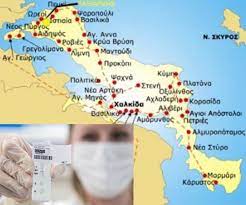 We did not find results for: Koronoios Eyboia Ypo Epithrhsh H Perifereiakh Enothta Eyboias Ti Metra 8a Isxyoyn Apo Ayrio To Prwi Xarths Evima Eidhseis Eyboia