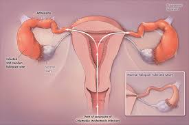 Darah yang menggumpal saat menstruasi adalah suatu kewajaran jika kamu mengalaminya. Darah Haid 7 Warna Gambaran Kesihatan Wanita Anda Yang Mana