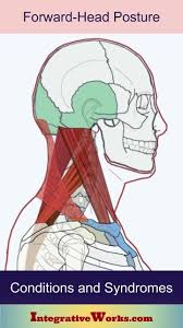 Pin On Craneal