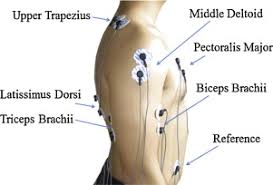 a comparison of upper limb motion pattern recognition using