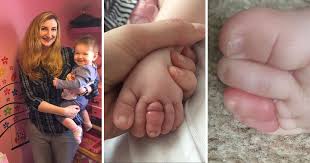 If you look under your vacuum, there may be hair bunched up and wrapped around the rollers. Mum Warns Parents Of How A Strand Of Hair Can Cost Children Their Toes Metro News
