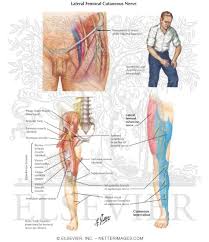 The lateral cutaneous nerve of the thigh (also called the lateral femoral cutaneous nerve) is a cutaneous nerve that innervates the skin on the lateral part of the thigh. Lateral Femoral Cutaneous Nerve