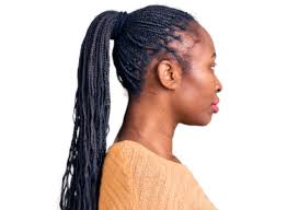 Image result for Alopecia