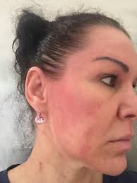 Vitamin c is quickly catching on as a potent skin care critical addition to everyone's skin care routine. Provence Beauty Rebalance Oil Argan Jojoba Reviews In Body Lotions Creams Chickadvisor