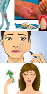 как очистить лицо от черных точек в домашних условиях содой Kogda Telo Prosit Pomoshi 10 Vazhnyh Priznakov Kotorye Vy Ne Mozhete Ignorirovat Vneshnost Disney Characters Disney Princess I Disney