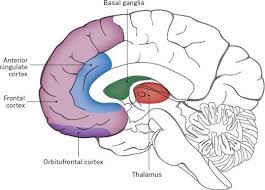 It's a terrible disorder you might want to rethink using it so lightly. International Ocd Foundation What Causes Ocd