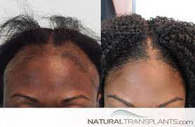 Pin On Hair Growth