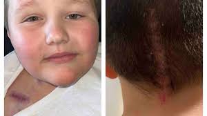 Fundraiser by Rebekah Laliberte : Help Support Wyatt Battling Stage 1  Ganglioglioma