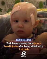 Her mother said one of the dogs ripped 12-by-12 centimeters of skin tissue  off the back of the child's head. She also suffered a skull fracture and  bite wounds to her lower
