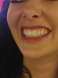 Dr. Gary Ricketts DDS