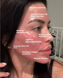 Meet 𝐊𝐲𝐥𝐞𝐞 𝐂𝐚𝐬𝐭𝐢𝐥𝐥𝐨 FNP