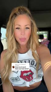 Replying to @It’s me Robin oh and i forgot PDO Threads 😬😅  #cosmeticprocedures #injectables #pdothreadlift #filler #plasticsurgery  #antiaging #fyp #beautytok