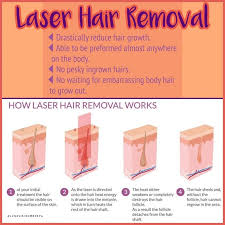 Laser Hair Removal Bikini Facts And Benefits Women Fitness Magazine Bikini Hair Removal Laser Hair Removal Laser Hair