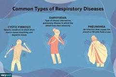 8 Common Respiratory Diseases
