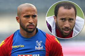 Andros Townsend Hair Transplant Turkey Price 2025