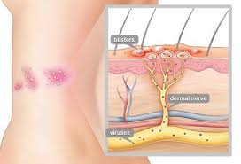 Pin On Medical Issues
