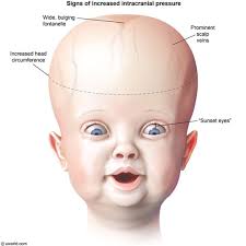 Stream househead21 music