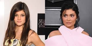To revisit this article, visit my profile, thenview saved stories. Kylie Jenner Denies Plastic Surgery But Credits Fillers For Her Look