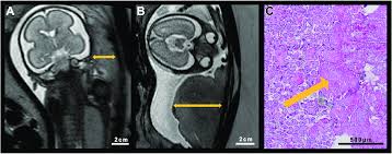 Image result for Mohria marginalis