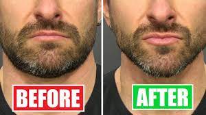 How to lose weight from your face. Do This To Lose Chubby Cheeks Get A More Defined Face Youtube