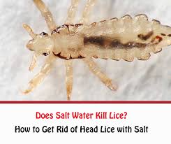 Epsom salt may also offer some deterrent value. How To Get Rid Of Head Lice With Salt Water Does Salt Water Really Kill Them Getridofallthings Com