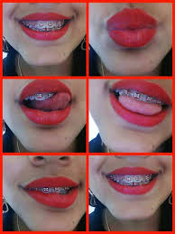 Ideala pentru calatorii, excursii sau alte ocazii. Aparate Dentare Posts Facebook