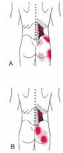 Image result for Trigger Point Location