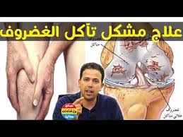 قد تكون دوالى الساق كبيرة أو بسيطة ظاهرة فى مكان معين بالساق وخصوصا حوالى الركبة أو اسفل الساق ولكنها غالبا ما تنتج من مشاكل فى مكان آخر بالساق. Ù…Ø´ÙƒÙ„ Ø¥Ø­ØªÙƒØ§Ùƒ Ø£Ùˆ ØªØ¢ÙƒÙ„ Ø§Ù„ØºØ¶Ø±ÙˆÙ Ùˆ Ø§Ù„Ù…ÙØ§ØµÙ„ Ø£Ø³Ø¨Ø§Ø¨Ù‡ ÙˆØ£ÙØ¶Ù„ Ø·Ø±Ù‚ Ù„Ø¹Ù„Ø§Ø¬Ù‡ Ùˆ ÙˆÙ‚Ø§ÙŠØ© Ù…Ø¹ Ø§Ù„Ø¯ÙƒØªÙˆØ± Ù…Ø­Ù…Ø¯ Ø£Ø­Ù„ÙŠÙ…ÙŠ Youtube English Grammar Sinusitis Health