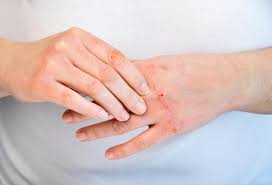 Наверное, каждый хотел бы побывать на экскурсии в прошлое. Bolezn Psoriaz Prichiny Simptomy I Metody Lecheniya Zabolevaniya Gancevichi Gazeta Gancavicki Chas