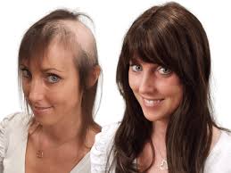 Mark Glenn Hair Enhancement, London, UK