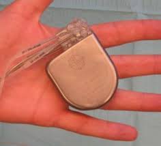 A handful of these changes pertain to mental disorders. Icd Ecgpedia