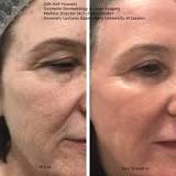 Image result
