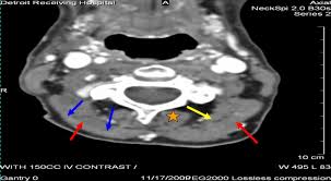 We did not find results for: Ct Anatomy Of Neck Anatomy Drawing Diagram