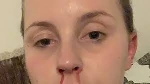 Mum living double life as cocaine addict reveals moment everything changed