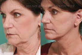 Ohio Head and Neck Surgeons