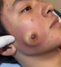 Says Yes Before Open Watch 📌​  https://thevanndy.com/dn/2025/08/30/dr-sandra-lee-745-15/