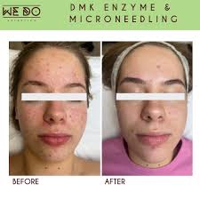 Time flies so fast… Our dear receptionist @amber.mcneely Amber moves to  Halifax. Dear may all heights be achieved and dreams come true. Thank for  being with us here at We Do Esthetics