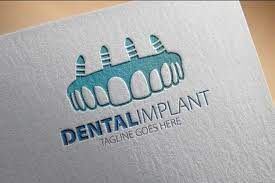 Create your own dental business cards. Dental Implant Business Card Design Dental Business Cards Dental Business Dental Clinic Logo
