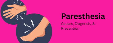 Image result for Paresthesia