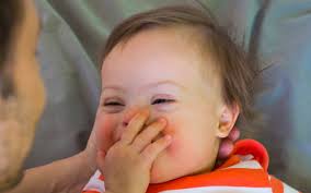 Differenza tra disabilità e malattia. Trapanese: "Siamo tutti difettati"