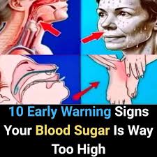 Early warning signs of high blood sugar