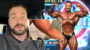 Chris Bumstead Reveals He Won 2022 Olympia Classic Physique Title With Torn  Bicep