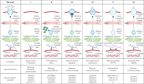 Cystic Fibrosis The Lancet