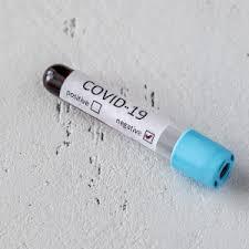 23,243 likes · 1,601 talking about this · 13 were here. Schweine Net Erlass Zu Regelmassigen Corona Tests Von Schlachthofmitarbeitern In Niedersachsen
