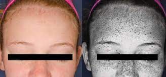 Pin On Teens Young Adults