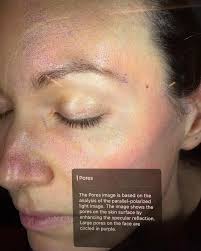 ⭐️Introducing the new skin analysis machine at Dr. Genna Kenny medical  aesthetics ⭐️ This provides a detailed assessment of skin health by  capturing high-resolution images and analyzing underlying conditions not  visible to