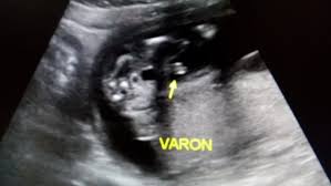 We did not find results for: Sexo De Mi Bebe Club De Julio 2019 Esperando Nuestras Bendiciones Babycenter
